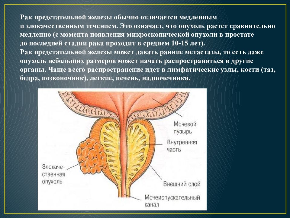 Предстательная железа центр. Парапростатическая клетчатка предстательной железы. Простата строение анатомия. Анатомия предстательной железы у мужчин. Объемное образование предстательной железы.