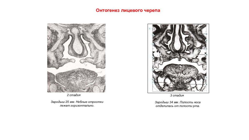Околоносовые пазухи таблица. Носовые пазухи строение у ребенка. Сроки формирования придаточных пазух носа. Классификация воспалительных заболеваний околоносовых пазух. Онтогенез околоносовых пазух.
