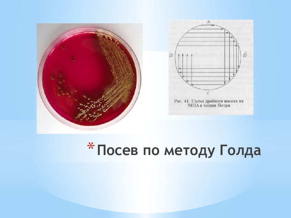 Посев условный. Посев по голду. Посев по голду микробиология. Посев по методу голда. Метод секторных посевов по голду.