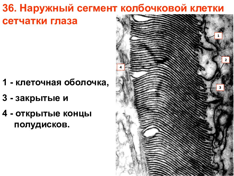 Внешние сегменты. Наружный колбочковый сегмент. Колбочконесущая клетка сетчатки Электронограмма. Наружный сегмент сетчатки. Электронограмма оболочки.