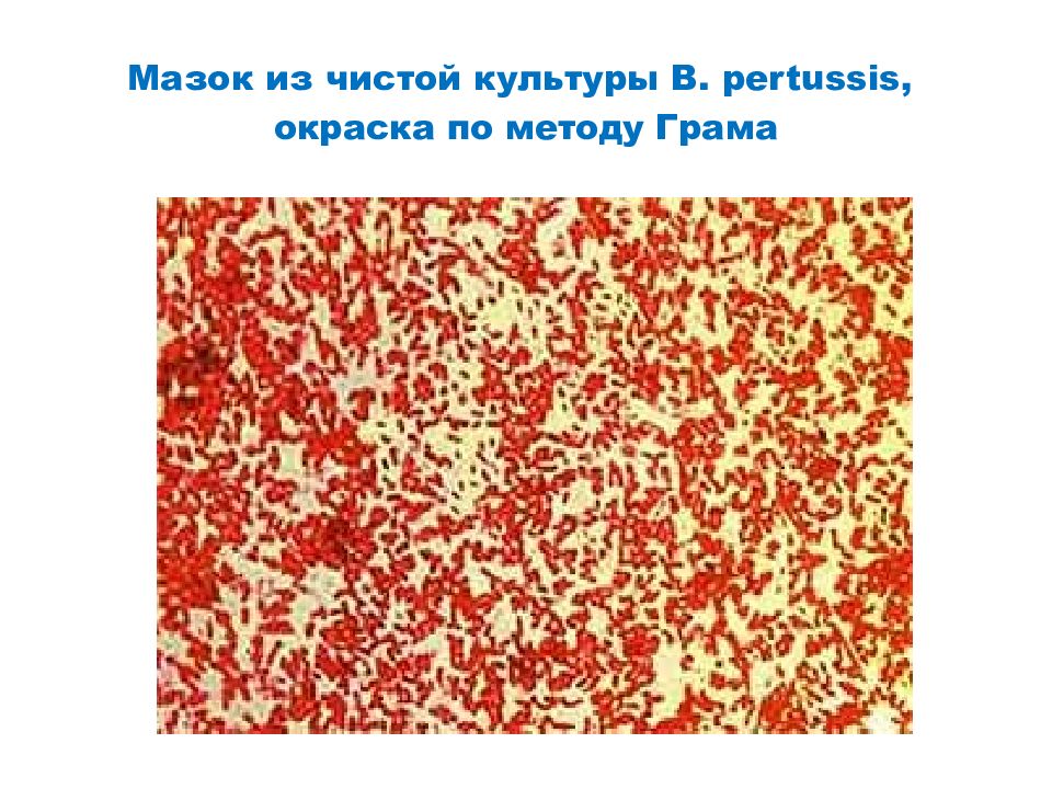 Мазок на коклюш. Возбудитель коклюша окраска по Граму. Bordetella pertussis, чистая культура, окраска по Граму. Бордетелла окраска по Граму. Мазок чистой культуры возбудителя коклюша.