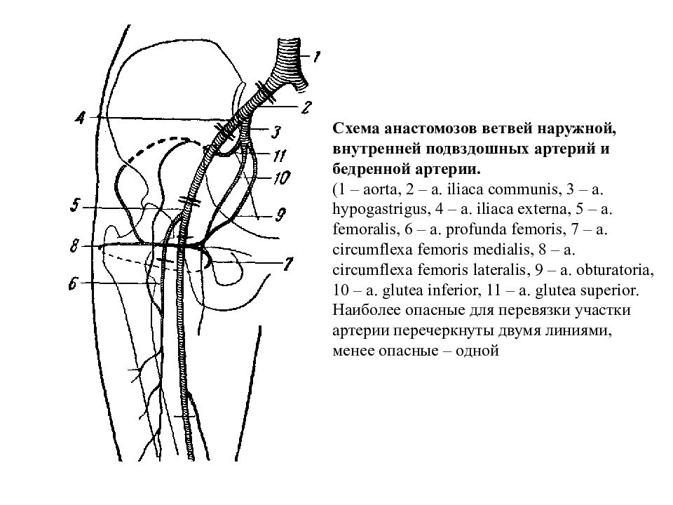 Оперативная хирургия нижней конечности презентация