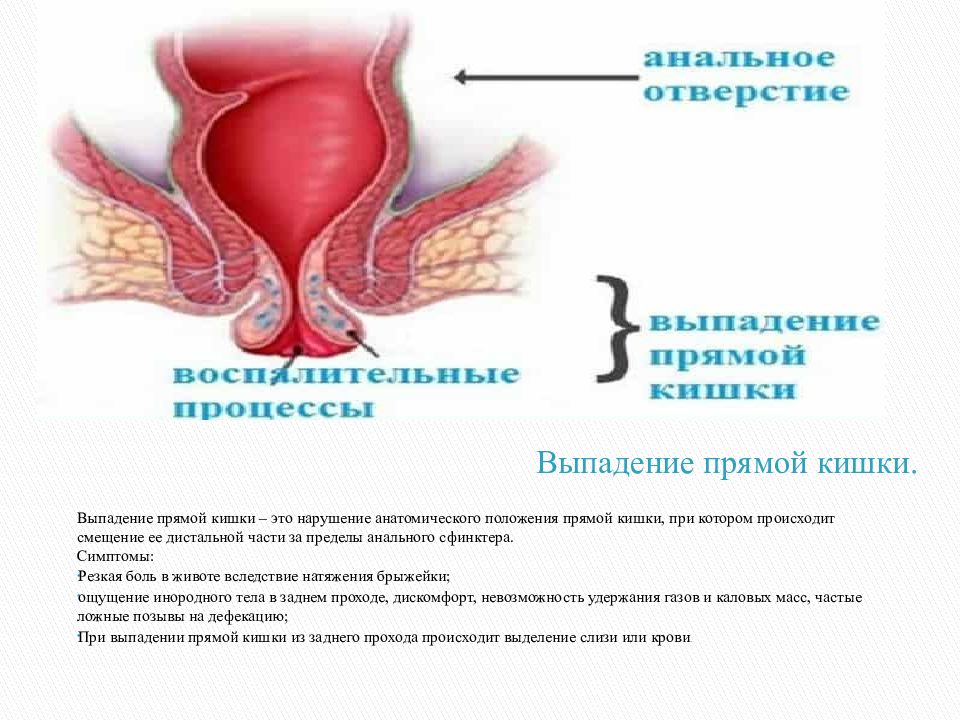 Почему После Секса Болит Вход