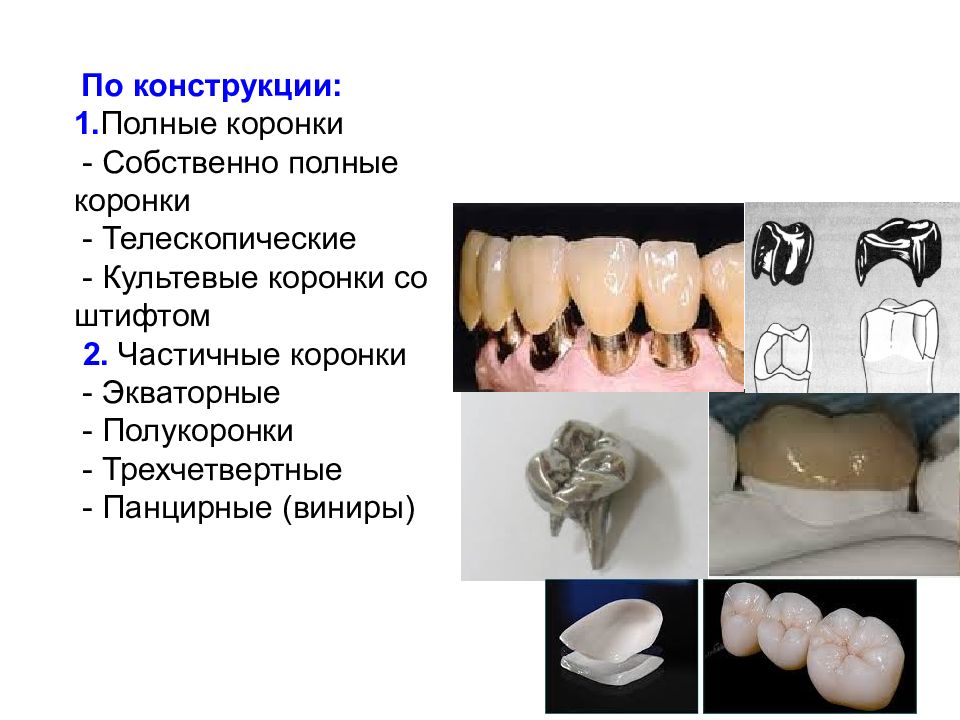 Искусственные коронки презентация