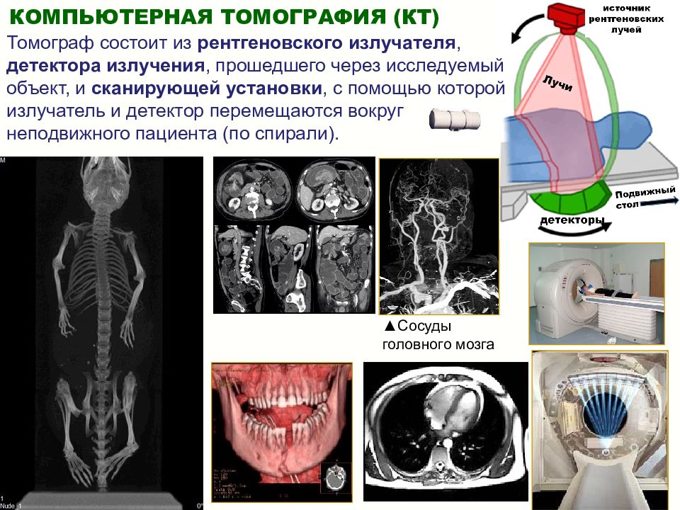 Презентация на тему ядерная медицина