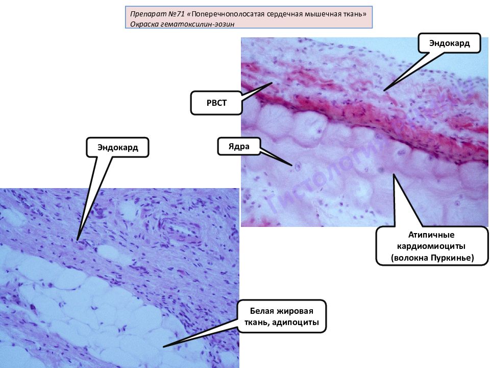 Волокна пуркинье препарат гистология рисунок