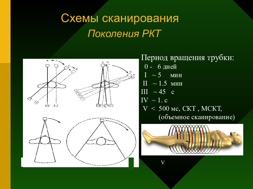 Чем рисуют разметку для лучевой терапии