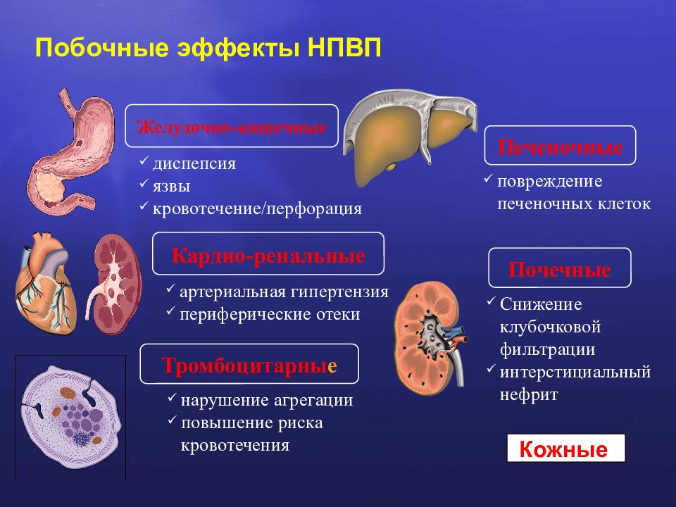 Препараты нпвс в картинках