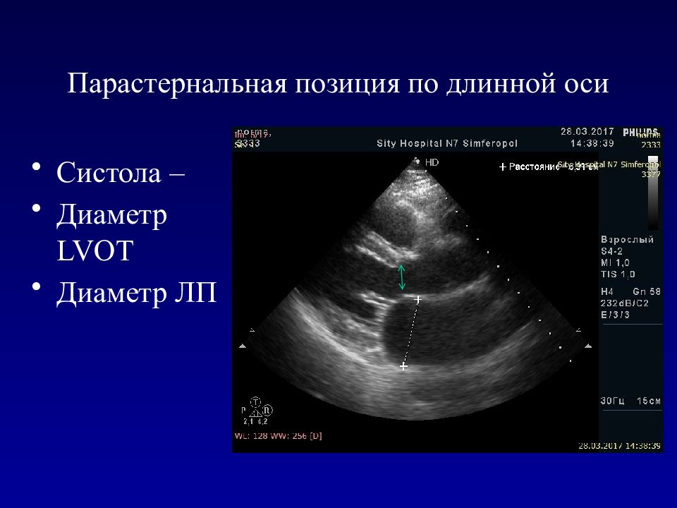 Эхокардиография сердца презентация