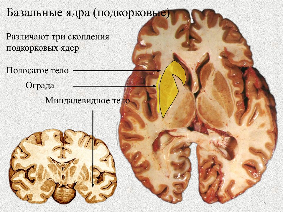 Хвостатое ядро мозга