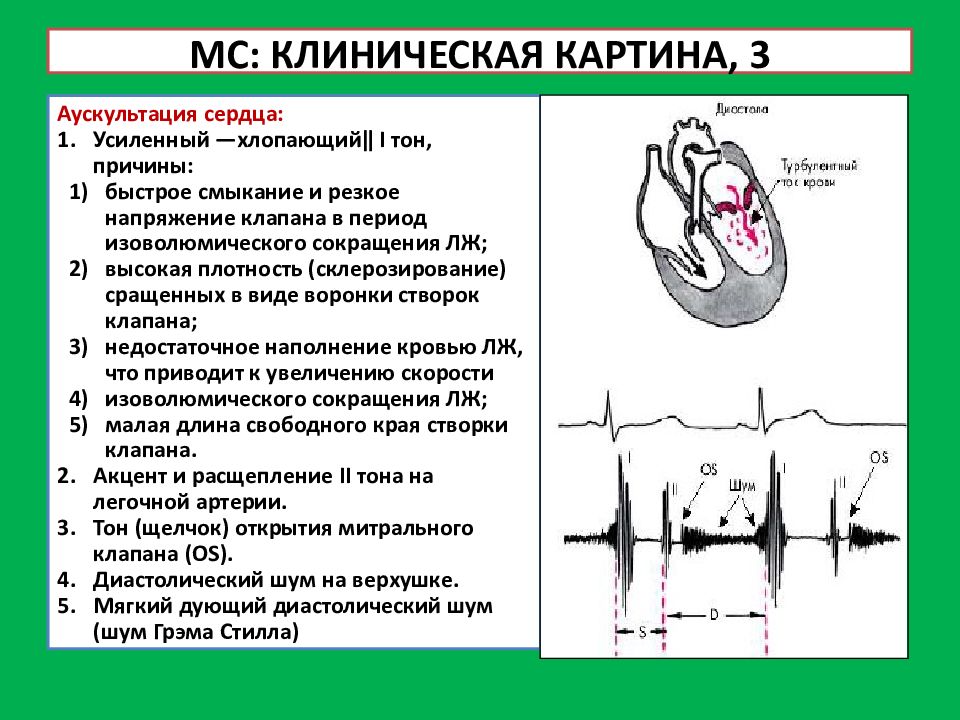 Аускультативная картина сердца у детей имеет следующие особенности