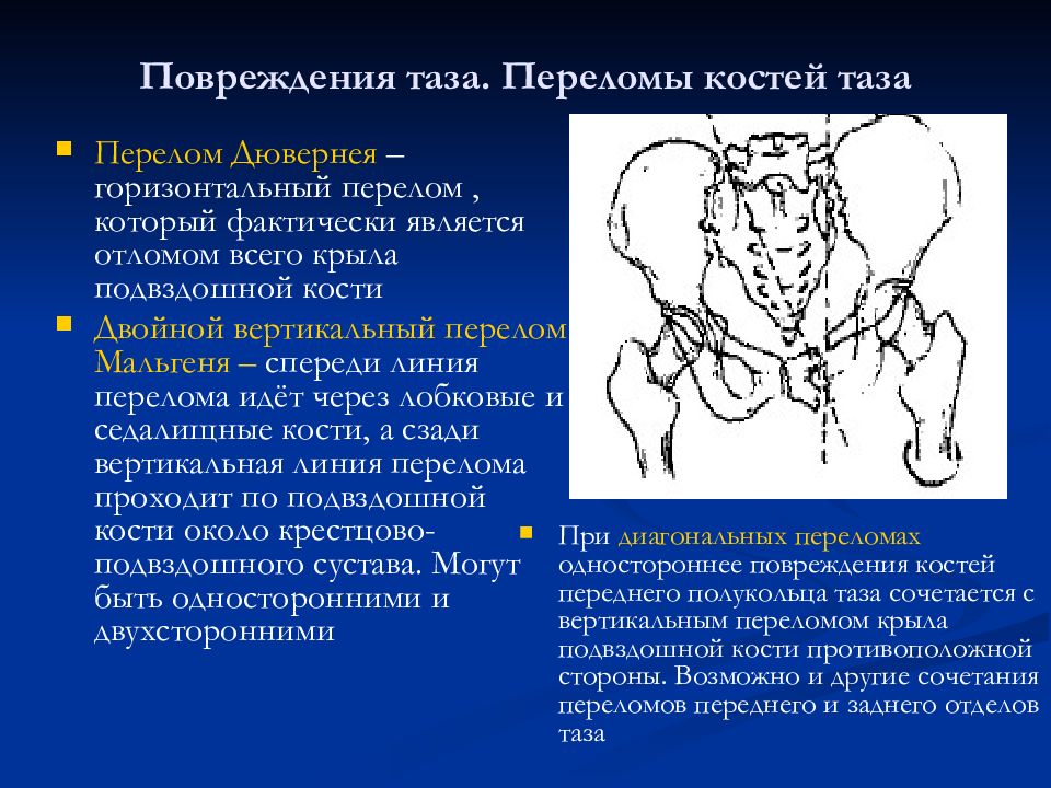 Повреждения таза презентация