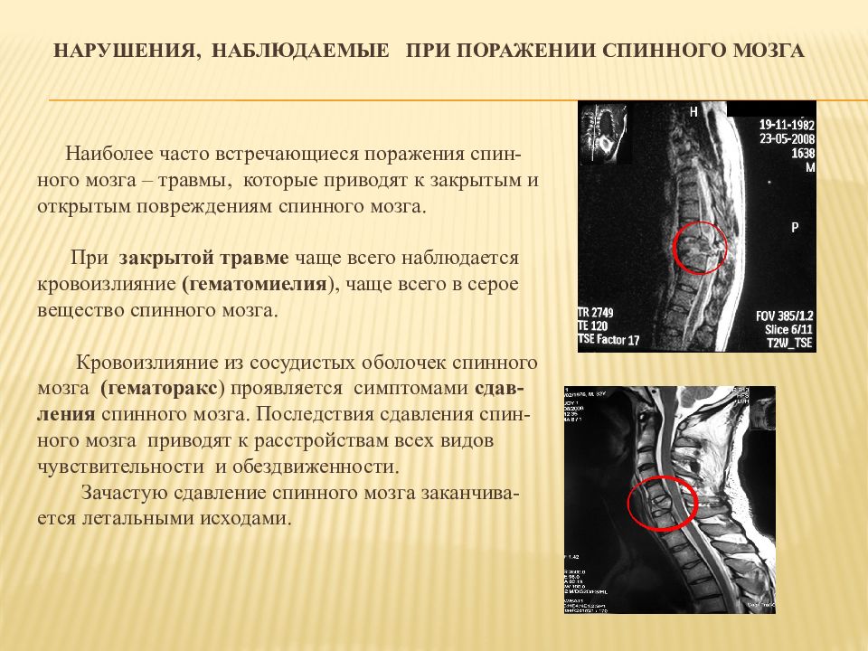 Травмы головного и спинного мозга презентация неврология