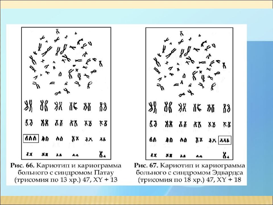 Кариотип человека определяют. Хромосомный набор кариотип человека рисунок. Идиограмма кариотипа. Сравните понятия: «кариотип» и «идиограмма». Задания на кариотип человека.