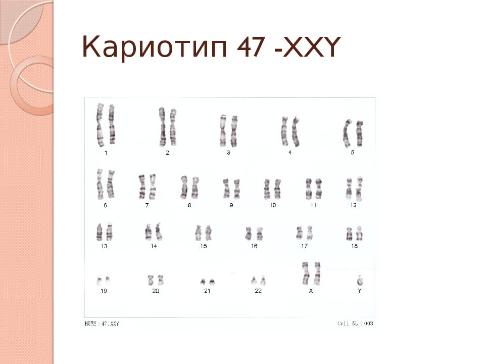 Xxy хромосомы