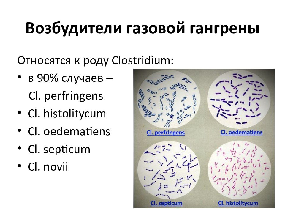 Возбудитель газовой гангрены рисунок