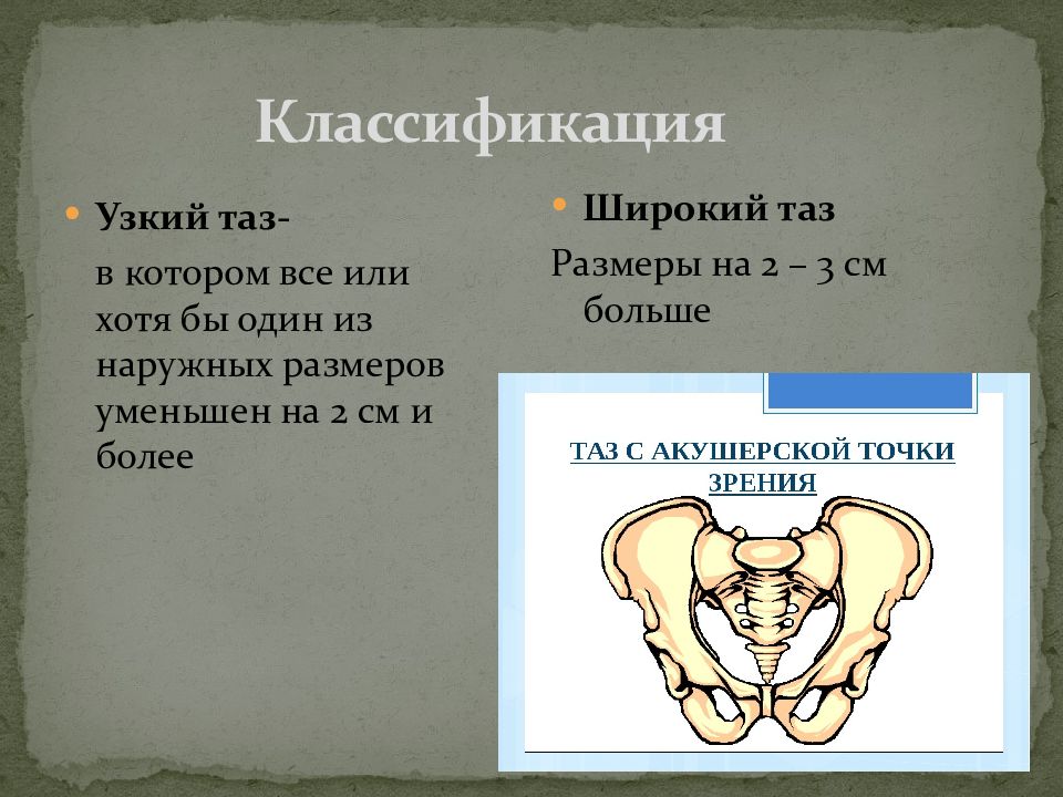 Таз в акушерстве презентация