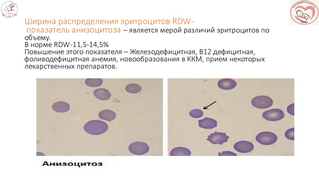 Распределение эритроцитов повышены