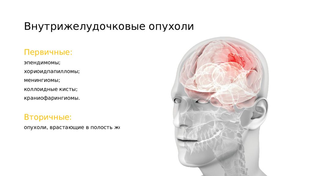 Опухоли нервной системы презентация