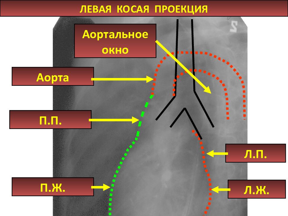 Косая проекция