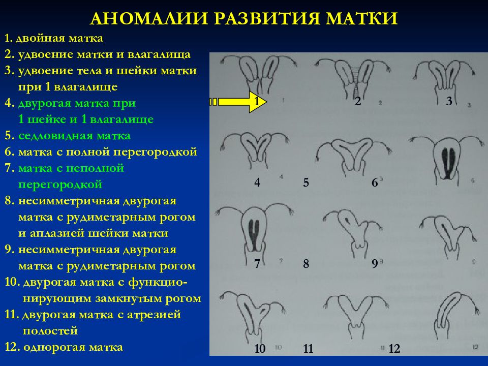 Аномалии развития яичников презентация