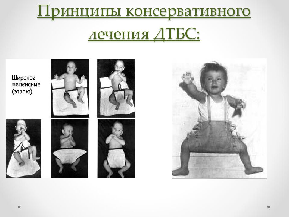 Принципы консервативного лечения ДТБС: