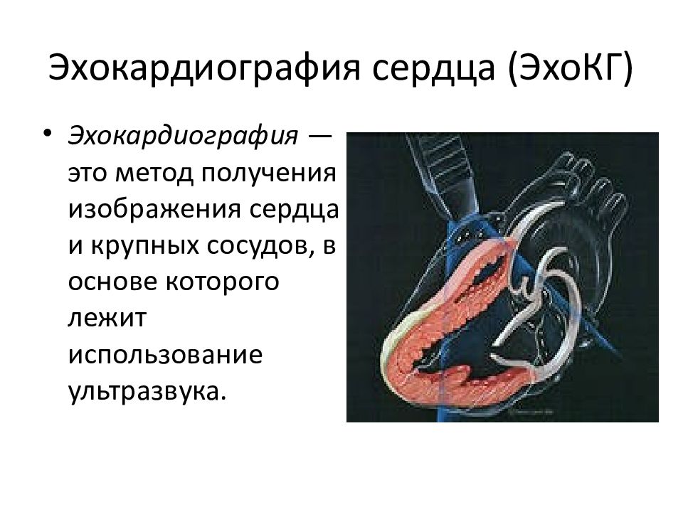 Эхокардиография сердца презентация