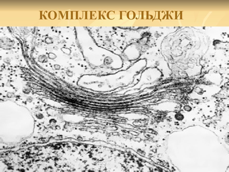 Комплекс гольджи гистология. Аппарат гольджи микрофотография. комплекс гольджи электронная микрофотография. аппарат гольджи строение гистология. комплекс гольджи электронограмма гистология.