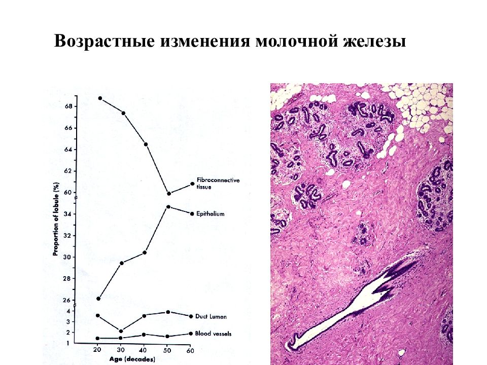 Изменения молочных. Молочная железа возрастные изменения. Возрастные изменения грудных желез. Возрастные изменения в молочной железе. Возрастные изменения молочных желез гистология.