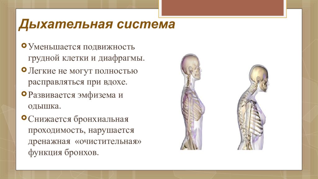 Здоровье лиц пожилого и старческого возраста презентация