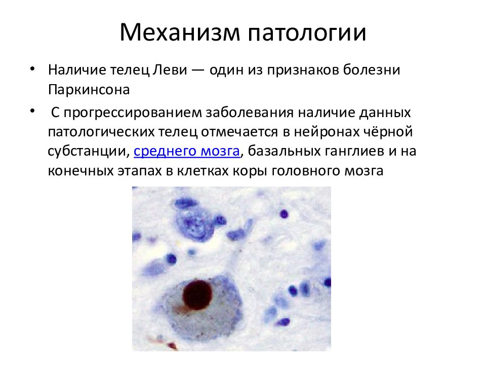 Презентация про болезнь паркинсона