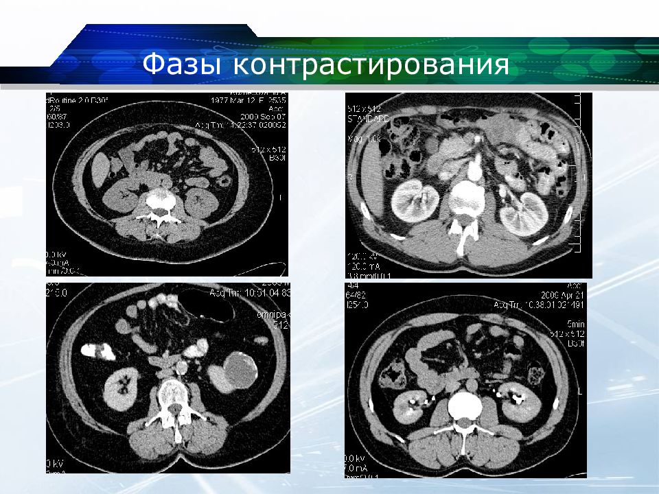 Кт почек презентация