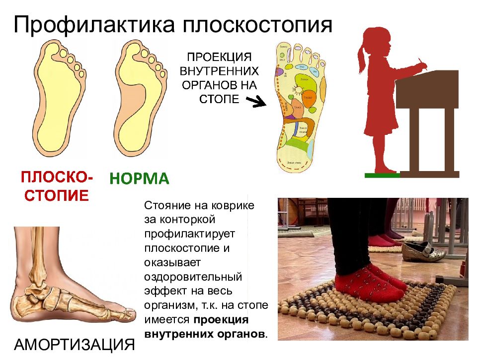 Выведенная стопа. Плоскостопие у детей дошкольного возраста и меры профилактики. Плоскостопие профилактика плоскостопия. Профилактика плоскостопия у детей. Профилактика плоскостопи.