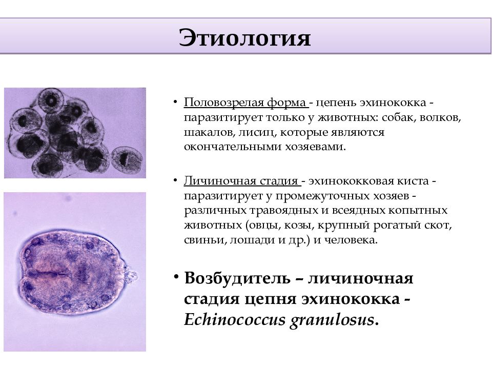 Эхинококкоз легких презентация