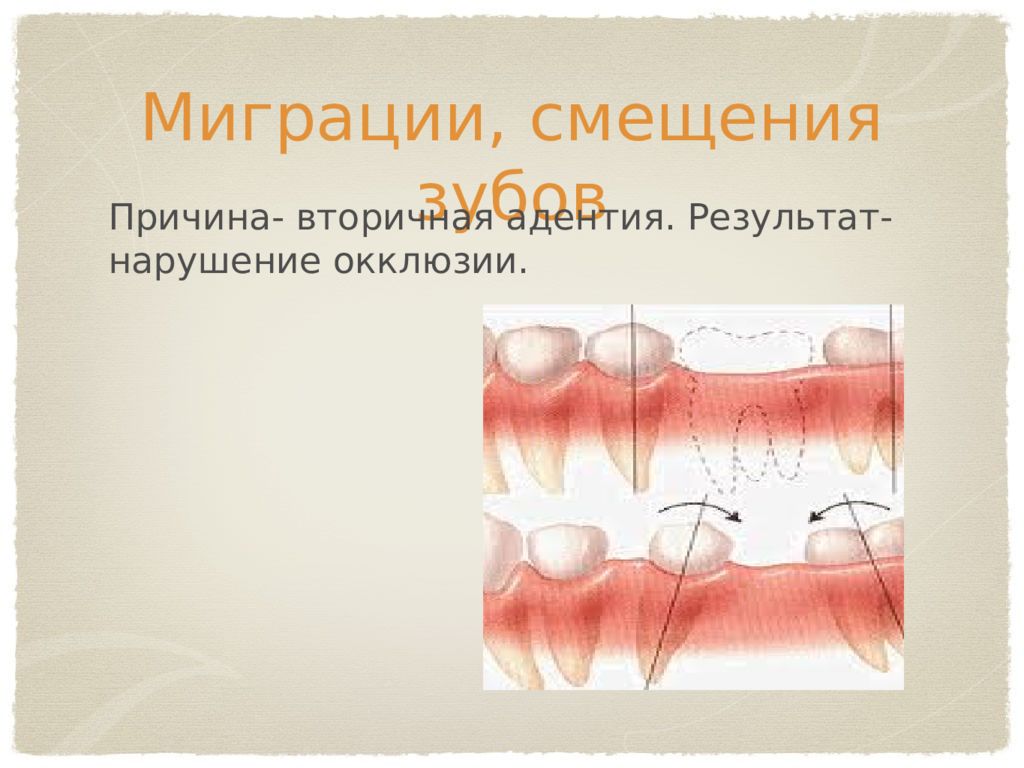 Основы окклюзионной диагностики презентация