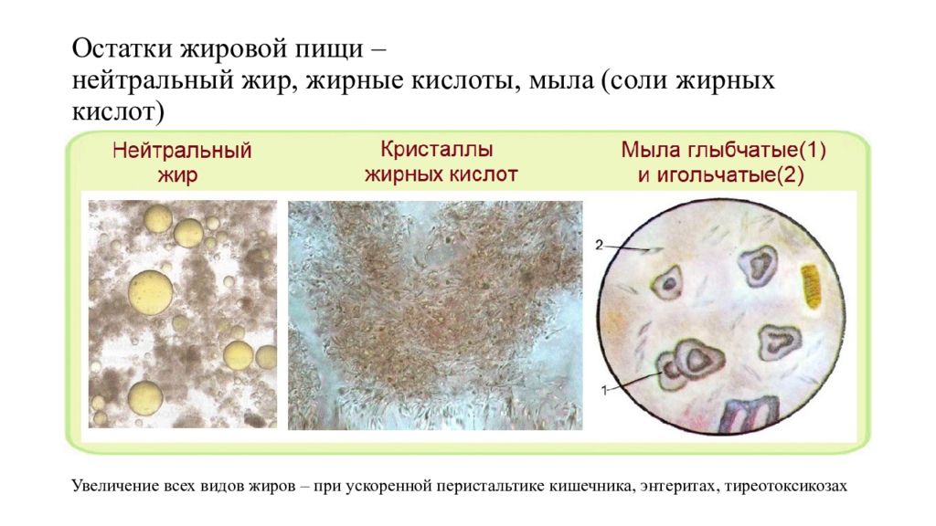 Нейтральный жир большом количестве