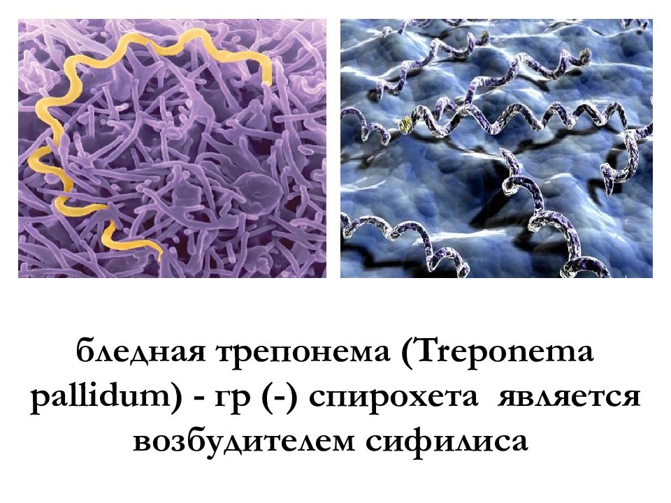 Бледная спирохета