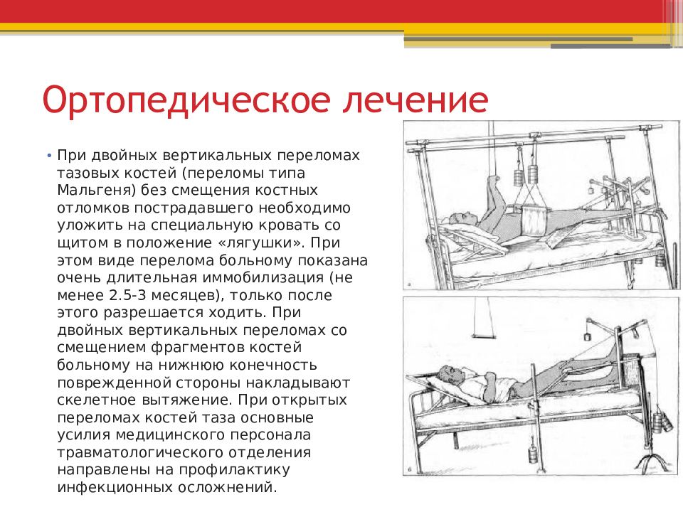 Переломы таза травматология презентация