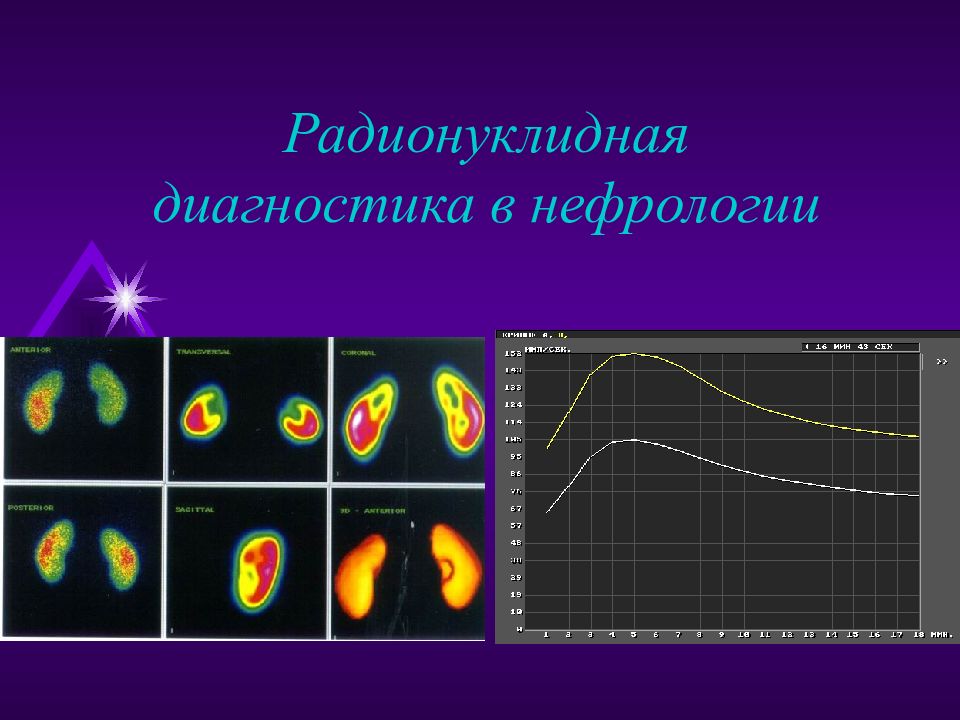 Радионуклидная диагностика. Радионуклидная диагностика в кардиологии. Диагностические методы в нефрологии. Радионуклидная диагностика в нефрологии.