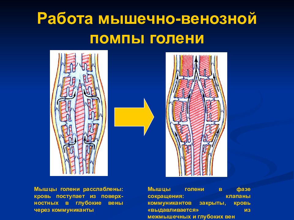 Вено венозном. Мышечно-венозная помпа нижней конечности. Эффект мышечно-венозной помпы нижней конечности. Мышечно венозная помпа голени. Клапаны вен нижних конечностей.