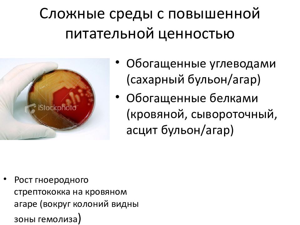 Сложные среды. Сахарный агар микробиология состав. Сахарный бульон среда микробиология. Сложные среды с повышенной питательной ценностью. Простые и сложные питательные среды.