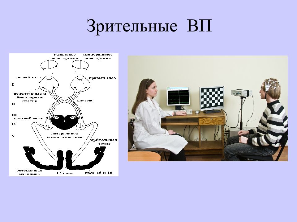 Зрительные вызванные потенциалы