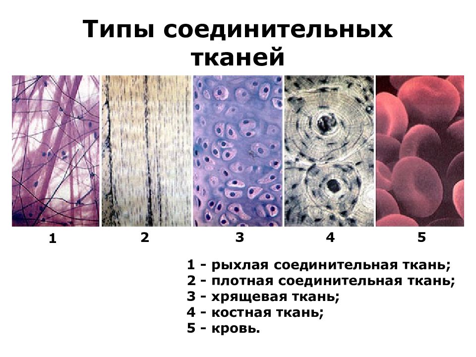 В состав какой ткани входят клетки. Соединительная ткань человека. Соединительная ткань рыхлая костная хрящевая. Структуры относящиеся к соединительной ткани. Ткань 1)  соединительная 2)  эпителиальная.