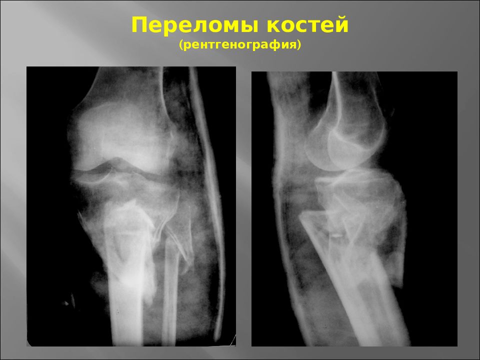 Основы травматологии презентация