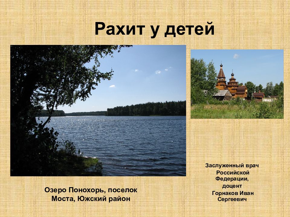 Рахит у детей
