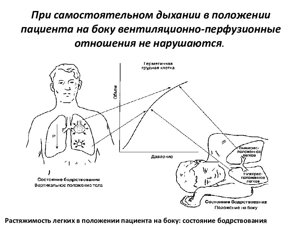 Вентиляция легких самостоятельно. Однолегочная вентиляция легких параметры. Однолегочная вентиляция в торакальной хирургии. Однолегочная ИВЛ. Вентиляционно-перфузионное отношение в легких.