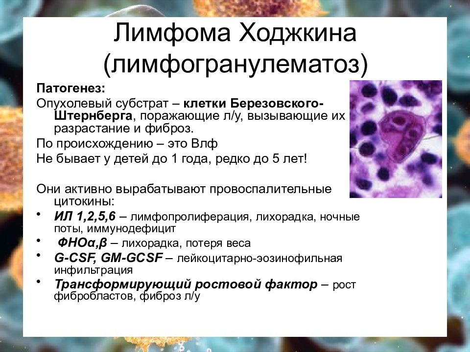Лимфоидная опухоль. Диагностические клетки лимфомы Ходжкина. Болезнь Ходжкина патогенез. Крупноклеточная лимфома патанатомия. Лимфома Ходжкина специфические клетки.