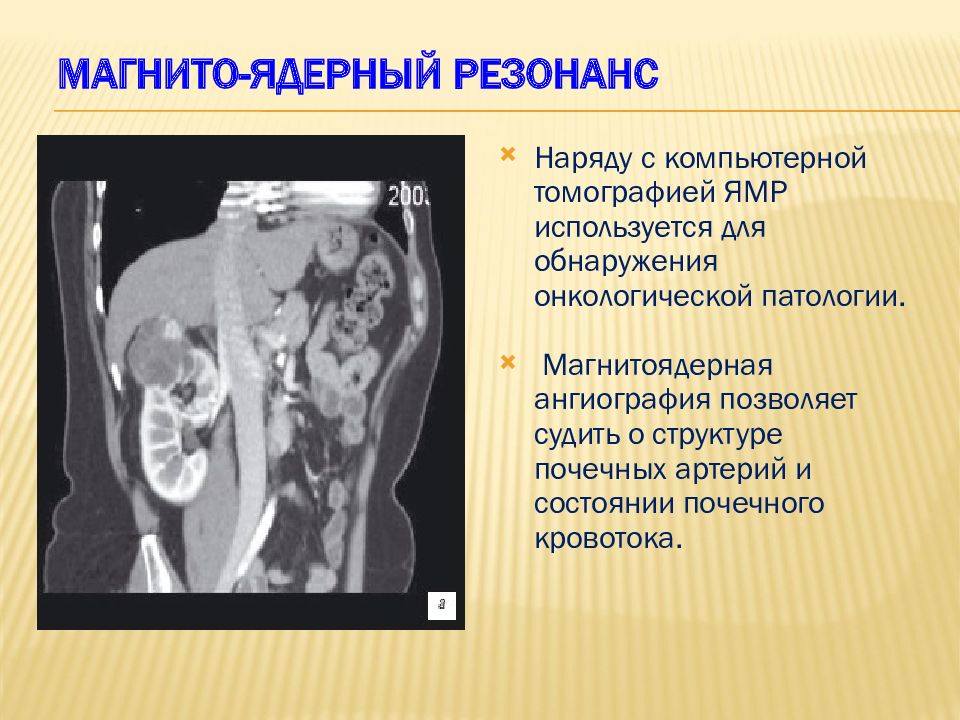 Патология почек презентация