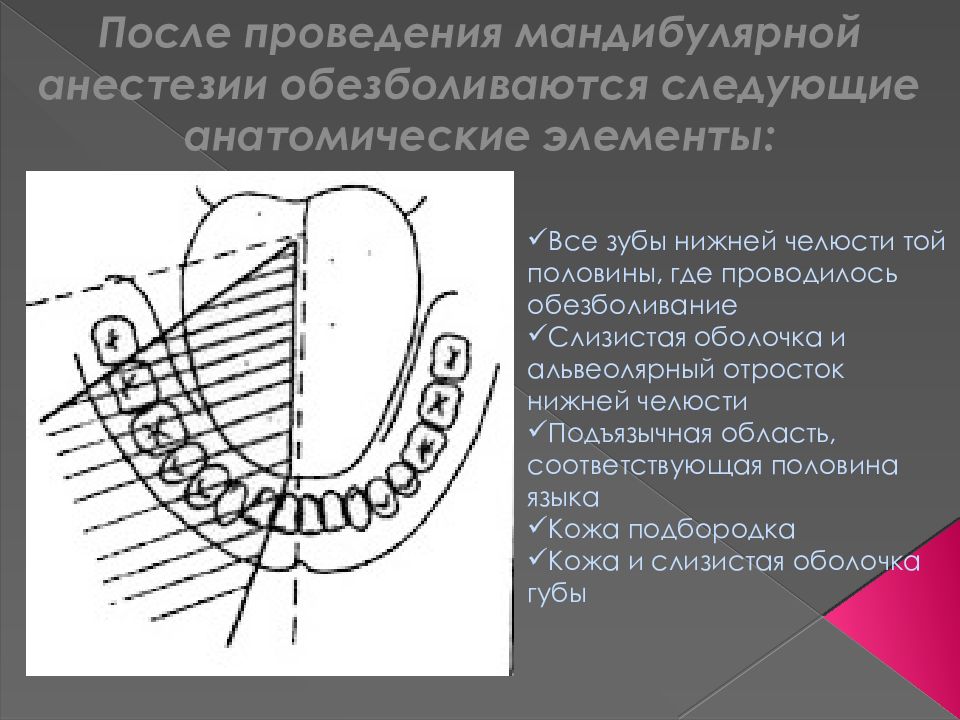 Мандибулярная анестезия презентация