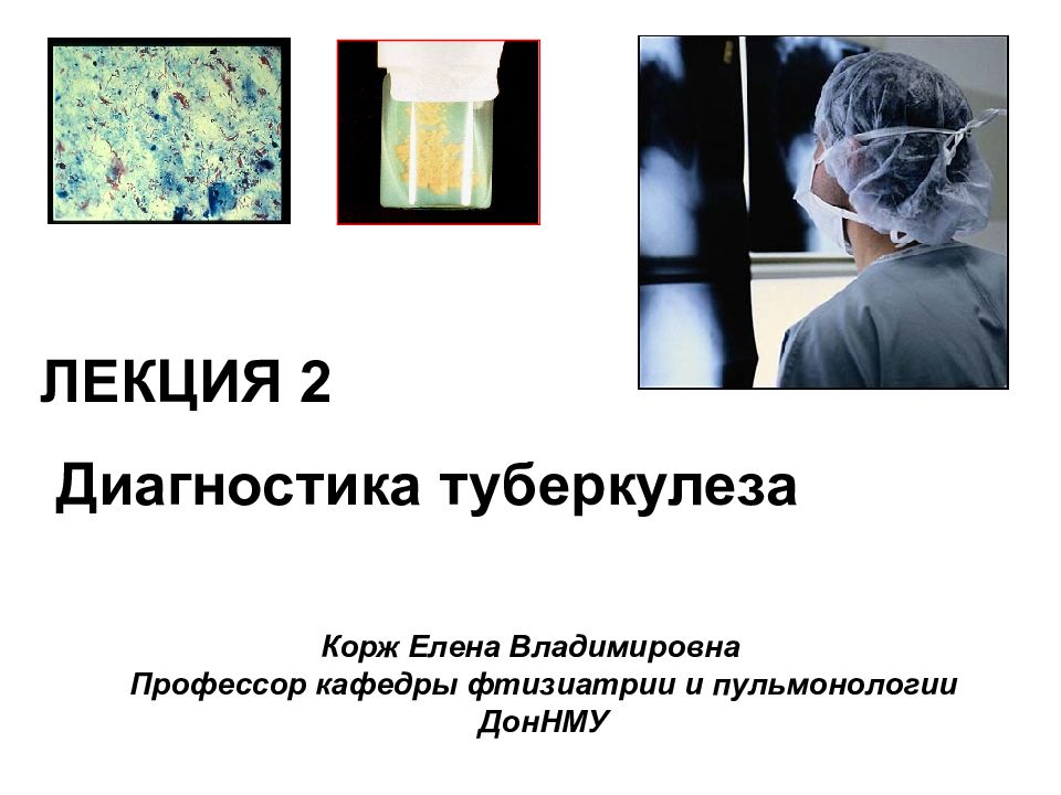 Туберкулез в стоматологии презентация